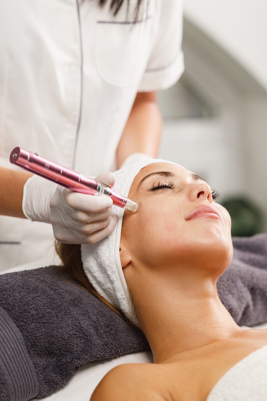Microneedling im Kosmetikstudio larcosmetic in Wien Liesing